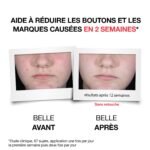 Neutrogena Anti-Boutons+ Serum Quotidien 30ml – Image 5