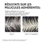 Vichy Dercos Shampoing Traitant Anti-Pelliculaire Cheveux Secs | 200ml = 1 Shampooing miniature Offert – Image 11