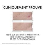 Vichy Normaderm Sérum Anti-imperfections PROBIO-BHA. Peau Grasse Acnéique | 30ml – Image 7