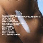 La Roche-Posay Cicaplast Baume Cicatrisant B5+ Peau Fragilisée | 40ml – Image 6